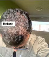 Stop Hair Fall from 7 Days – Get Thick, Strong Hair Naturally