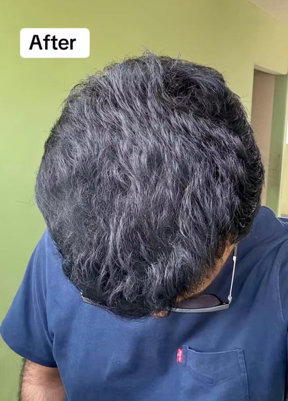 Stop Hair Fall from 7 Days – Get Thick, Strong Hair Naturally