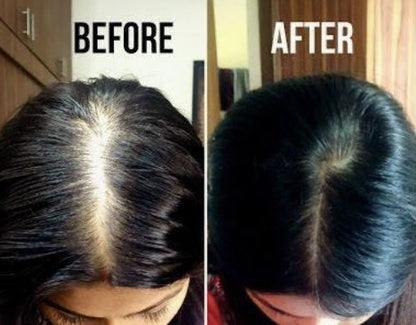 Stop Hair Fall from 7 Days – Get Thick, Strong Hair Naturally